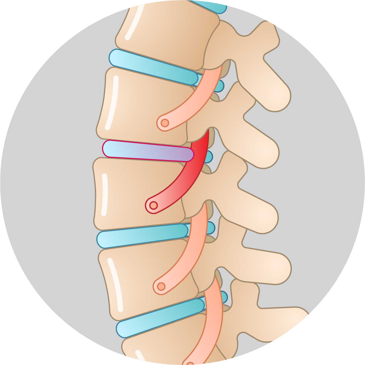 Neurosurgery